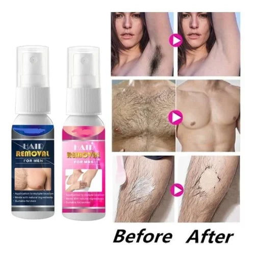 HairRemov ™ - Hair Removal and Body Hair Growth Inhibitor Spray (Free Today)